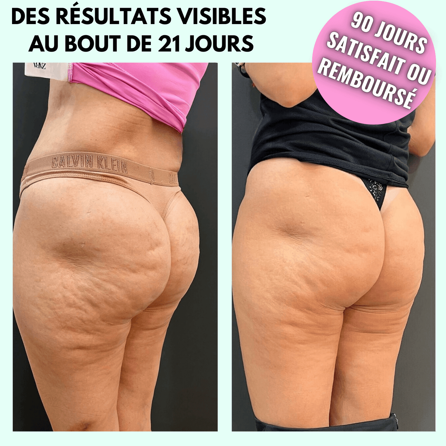 VIBRÉO - Appareil Anti-Cellulite & Brûle-Graisse